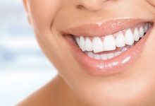 Zirkonyum Kaplama Diş Fiyatları ve Tedavi Süresi