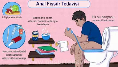 Anal Fissür (Makat Çatlağı) Belirtileri ve Tedavi Yöntemleri