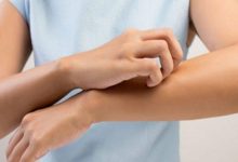 Atopik Dermatit Nedir? Belirtileri ve Tedavi Yöntemleri